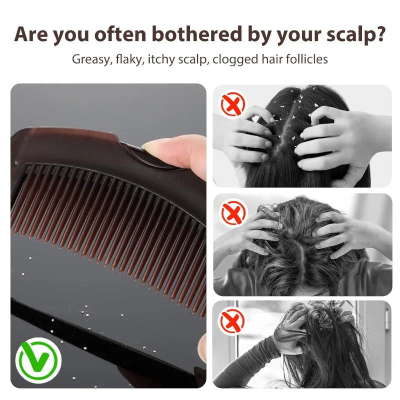 YOPOLL Scalp Exfoliating Comb – Dandruff Removal & No-Wash Massage Tool for Flaky, Oily Scalp Relief
