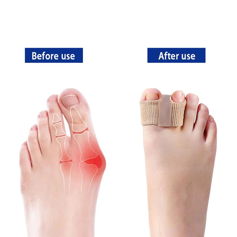 Woyuosn Premium Elastic Toe Separators – Comfortable Pain Relief & Alignment