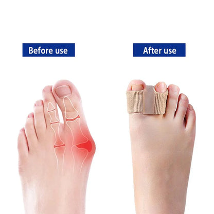 Woyuosn Premium Elastic Toe Separators – Comfortable Pain Relief & Alignment